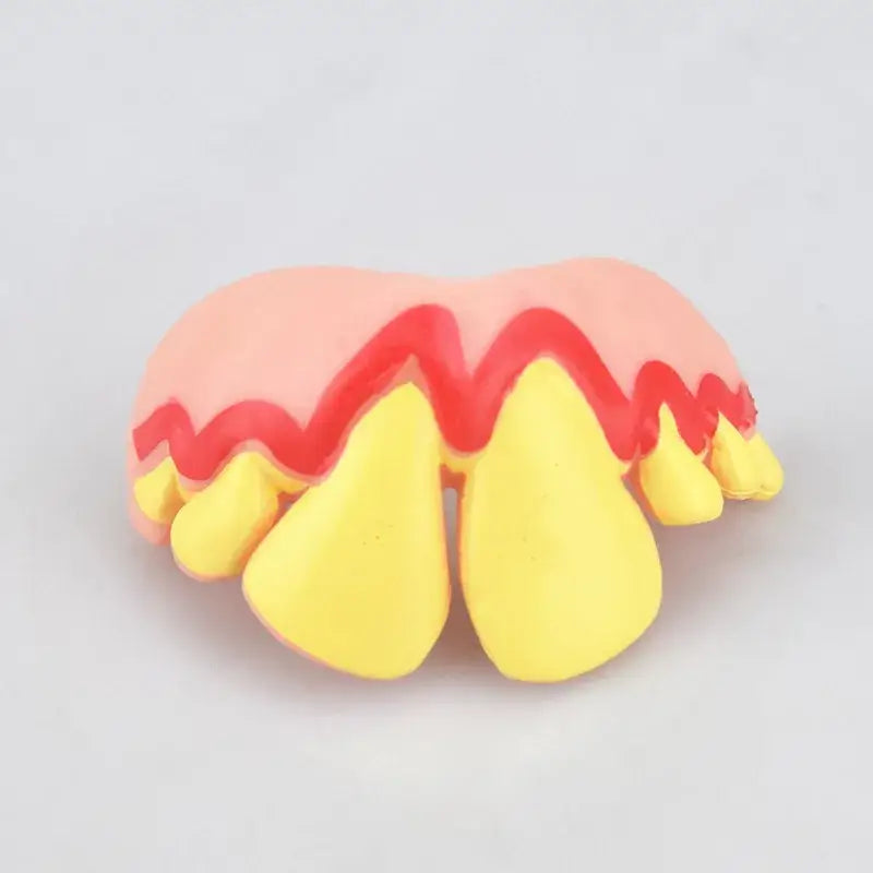 Novelty fake teeth with exaggerated yellow and red coloring.